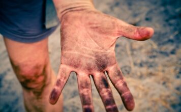 Dlaczego cały czas mam brudny odbyt? Dlaczego cały czas mam brudny odbyt?