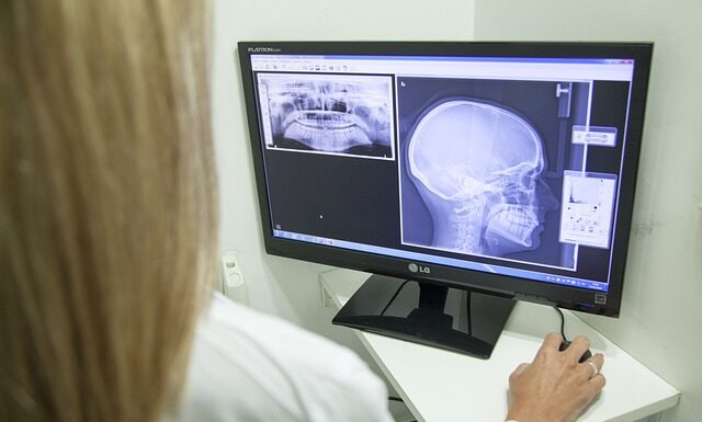 Jak mieć widoczna Żuchwę?